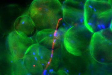 Cellule del tessuto adiposo (fonte: UMHealthSystem, via Flickr)